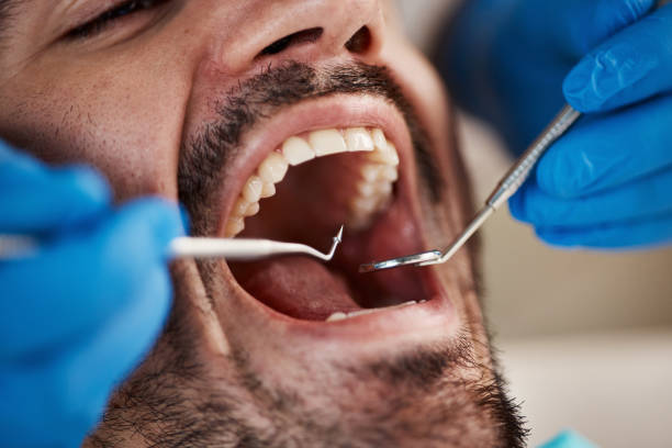 Best Emergency Gum Pain Relief  in Compo, CT